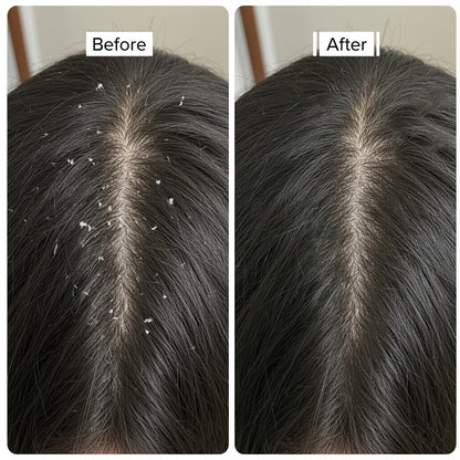 Bioderm Anti Dandruff Shampoo | Advanced Flake Control & Scalp Purifying Formula