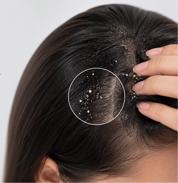 Dandruff & Scalp Care