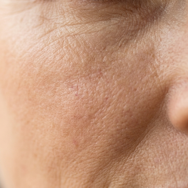 Anti-Aging & Wrinkles