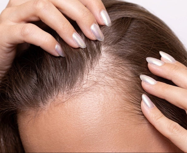Hairfall and Breakage